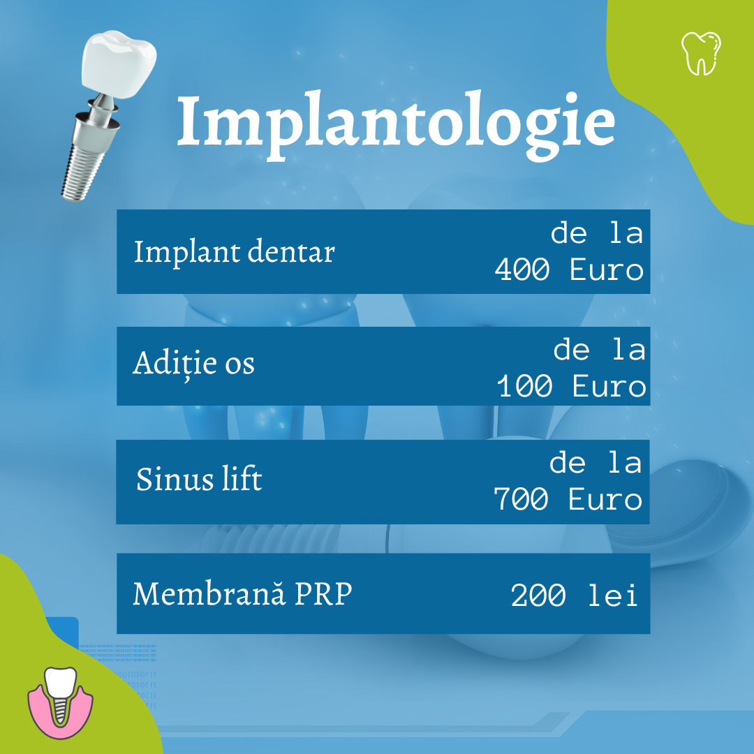 Implantologie - Times Dent